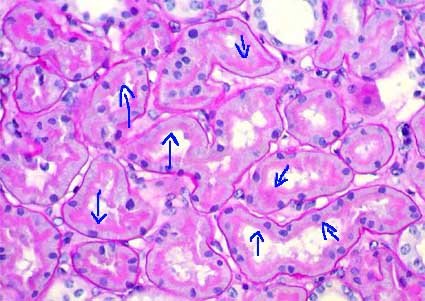 Kidney Tubule Histology