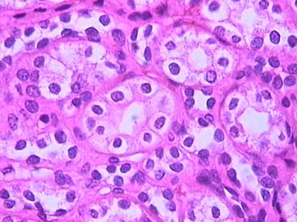 Renal Tubule Histology Slide